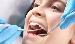 Get your wisdom teeth fixed With Wisdom Tooth Extraction Medisave