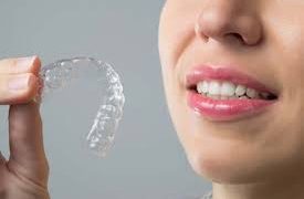 Invisalign in downtown Vancouver